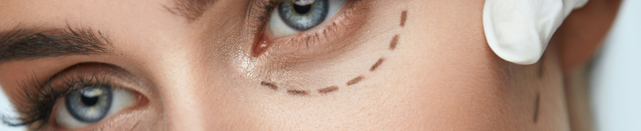 plastische-chirurgie